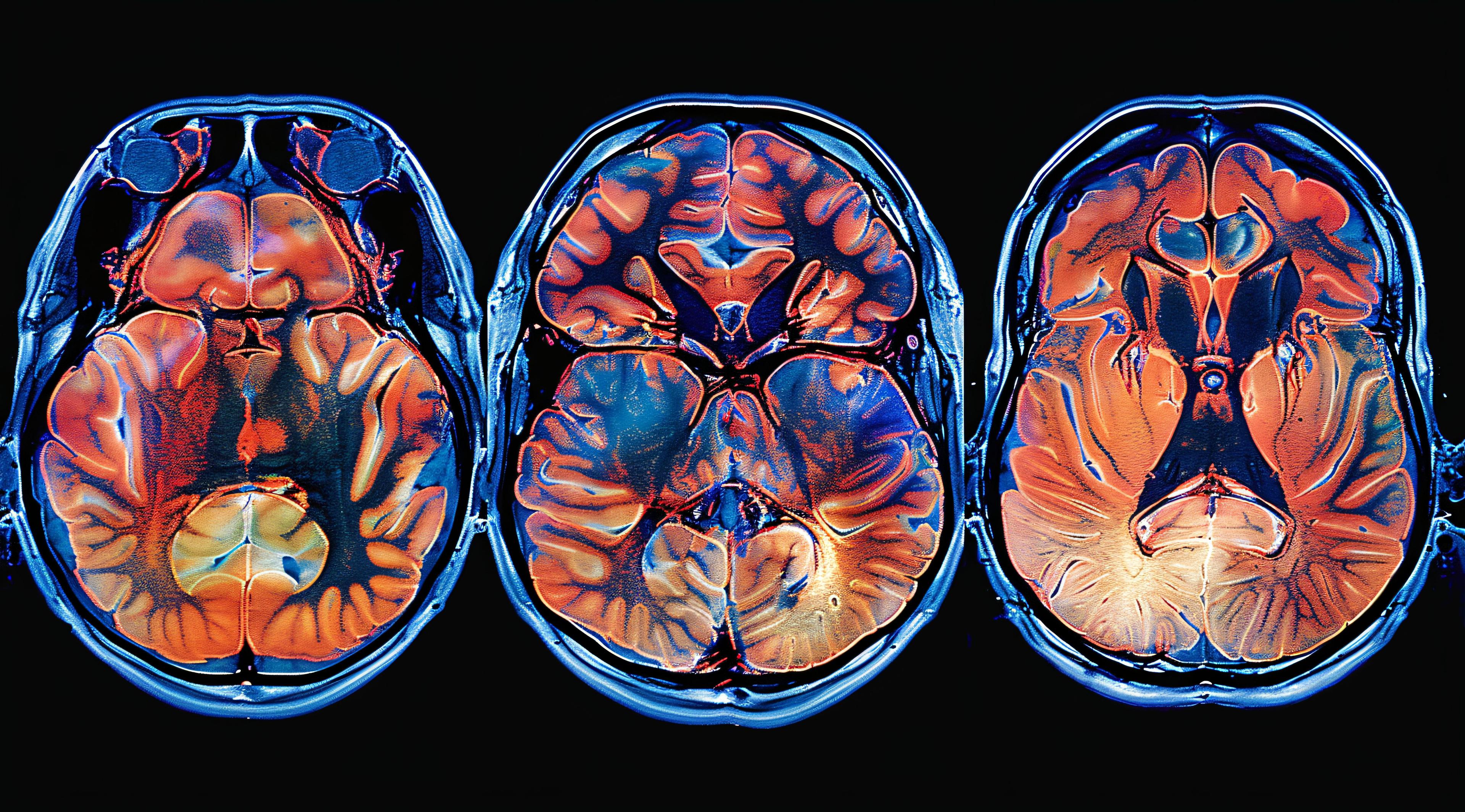 NIRS is Transforming Clinical Brain Imaging ©  MAJGraphics - stock.adobe.com