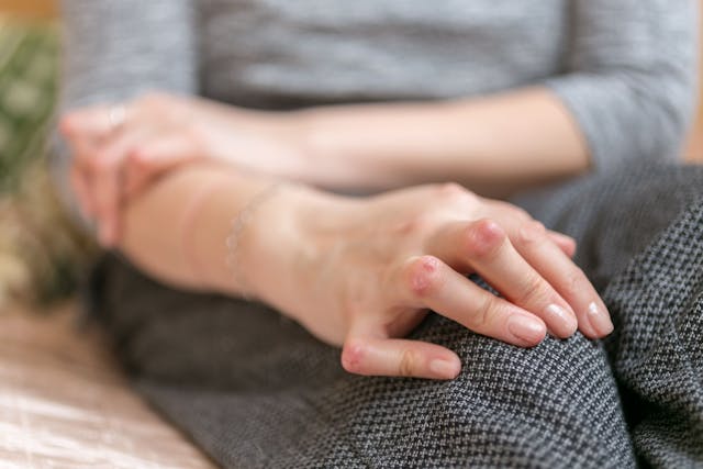 Young woman having rheumatoid arthritis takes a rest sittinng on the couch. Hands and legs are deformed. She feels pain. Selected focus. | Image Credit: © Valentina - stock.adobe.com